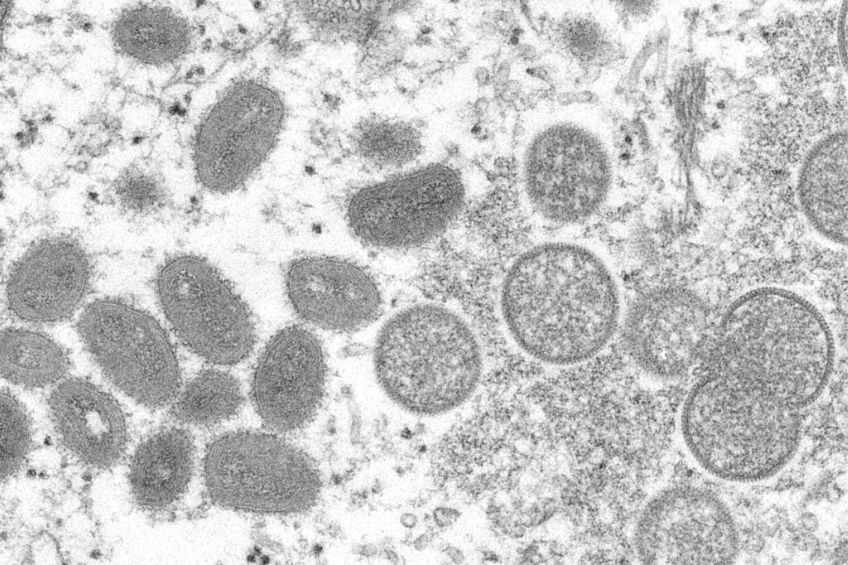 Virus de la viruela del mono vista desde un microscopio