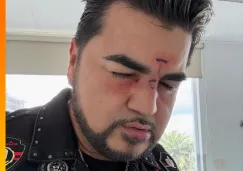 El cantante agradeció al doctor que lo atendió por sus heridas. El cantante agradeció al doctor que lo atendió por sus heridas.