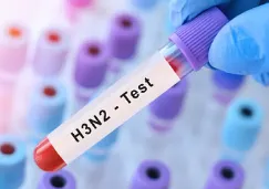 ¿Tengo gripe H3N2 tipo K? Así es la prueba que detecta esta “súper gripe” ¿Tengo gripe H3N2 tipo K? Así es la prueba que detecta esta “súper gripe”