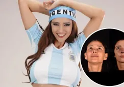 Dorismar reaparece con su nueva nariz tras cirugía reconstructiva: así avanza su recuperación Dorismar reaparece con su nueva nariz tras cirugía reconstructiva: así avanza su recuperación