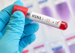 ¿Cuáles son los síntomas? Influenza deja 7 muertes y más de 2 mil casos en México ¿Cuáles son los síntomas? Influenza deja 7 muertes y más de 2 mil casos en México