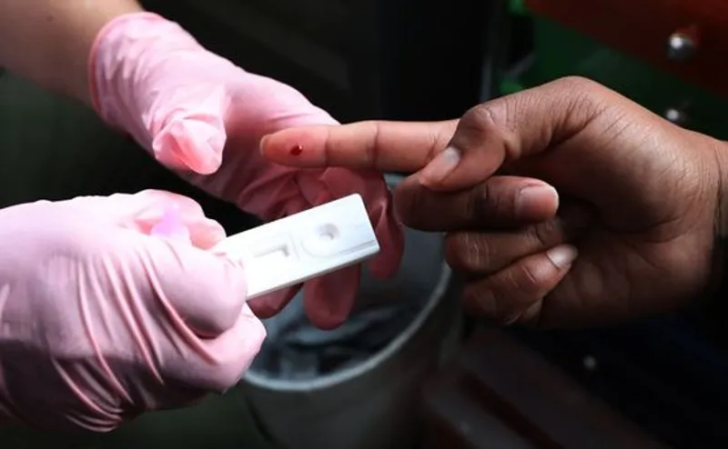 EFE Prueba para detectar VIH