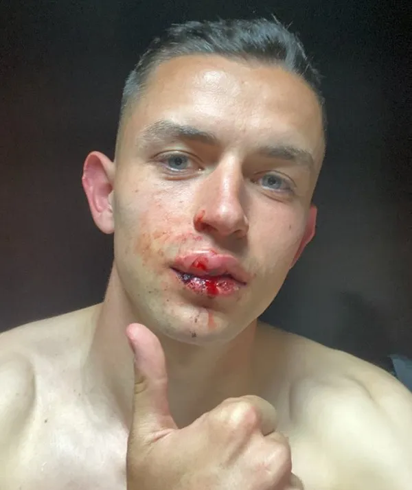 IMAGO7 Álvaro Fidalgo tras partido contra Santos