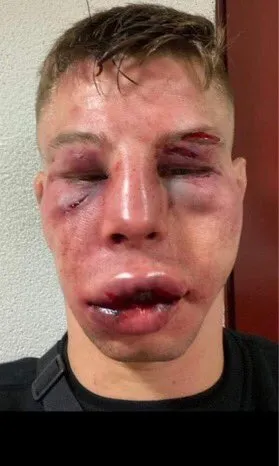 ESPECIAL Makarowski tras su pelea ante Blezien