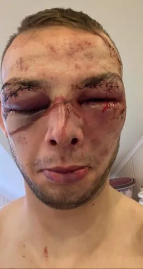 ESPECIAL Blezien tras su pelea ante Makarowski