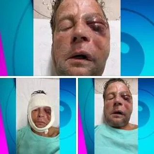 ESPECIAL Adame, tras salir de operación