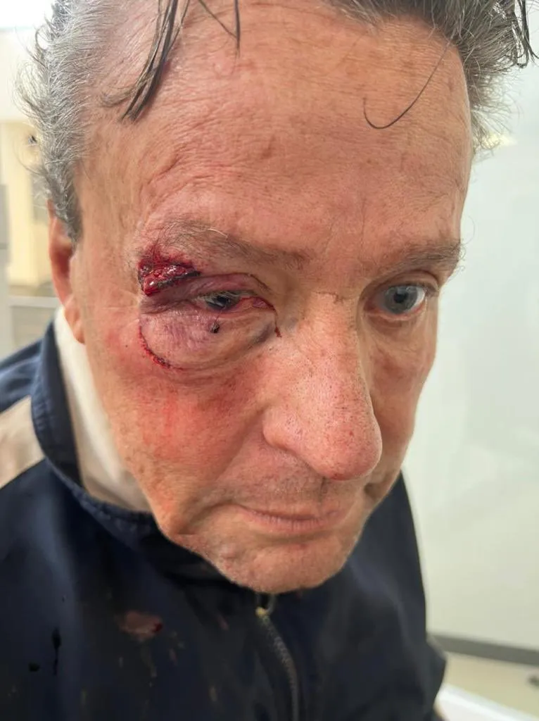 ESPECIAL Adame, tras ser golpeado en la calle