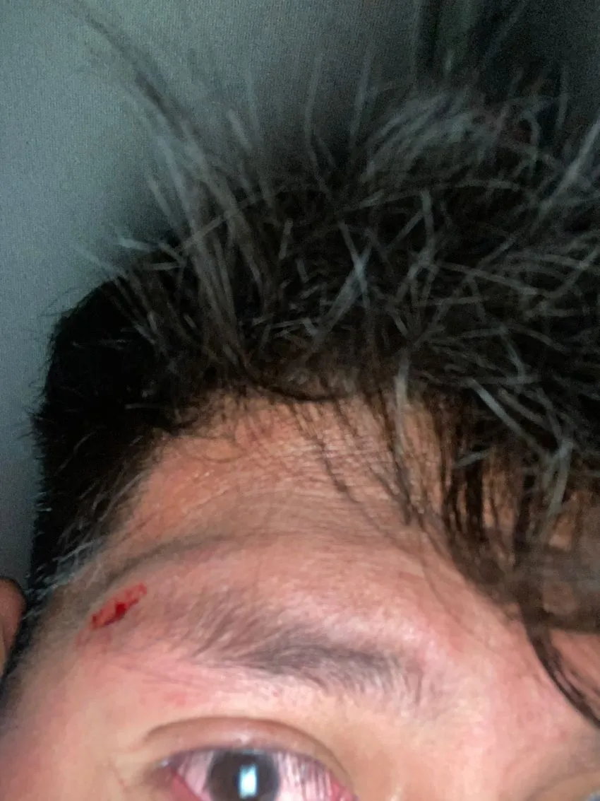 FOTO: TWIITER @TereFloresH Herida a un miembro de la familia de Teresa Flores por la bronca con franeleros