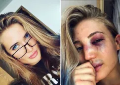 Anastasia Yankova antes y despues de la pelea