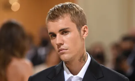 Justin Bieber: Anunció que padece parálisis facial y cancelará conciertos