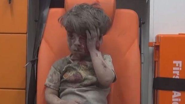 Omran Daqneesh, sentado en una banca tras ser rescatado