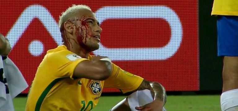 Neymar, ensangrentado tras el codazo de Duk