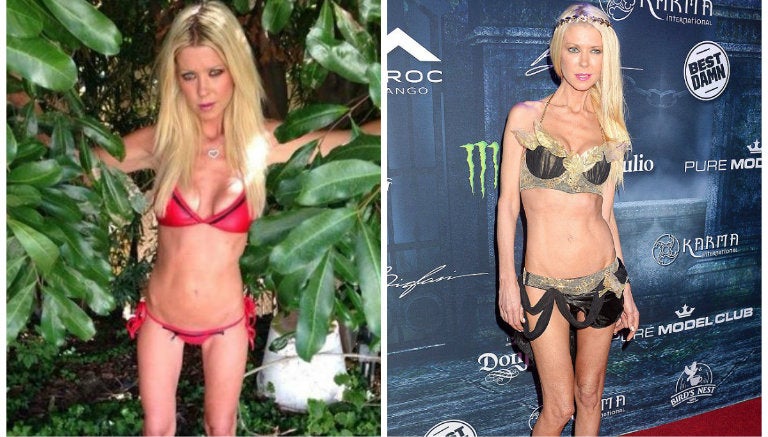 Tara Reid ahora causa polémica con su extremada delgadez