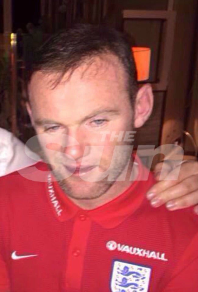 Postura de Rooney tras la 'borrachera' en el hotel 