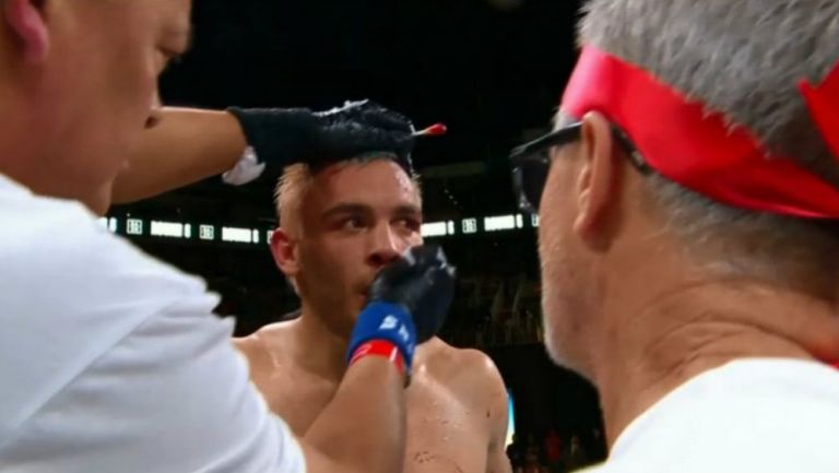 Chávez Jr tras la pelea contra Daniel Jacobs