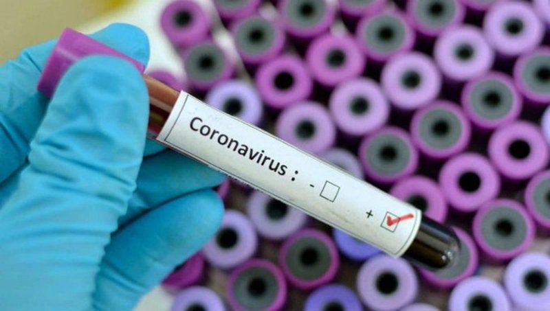 Prueba de Coronavirus