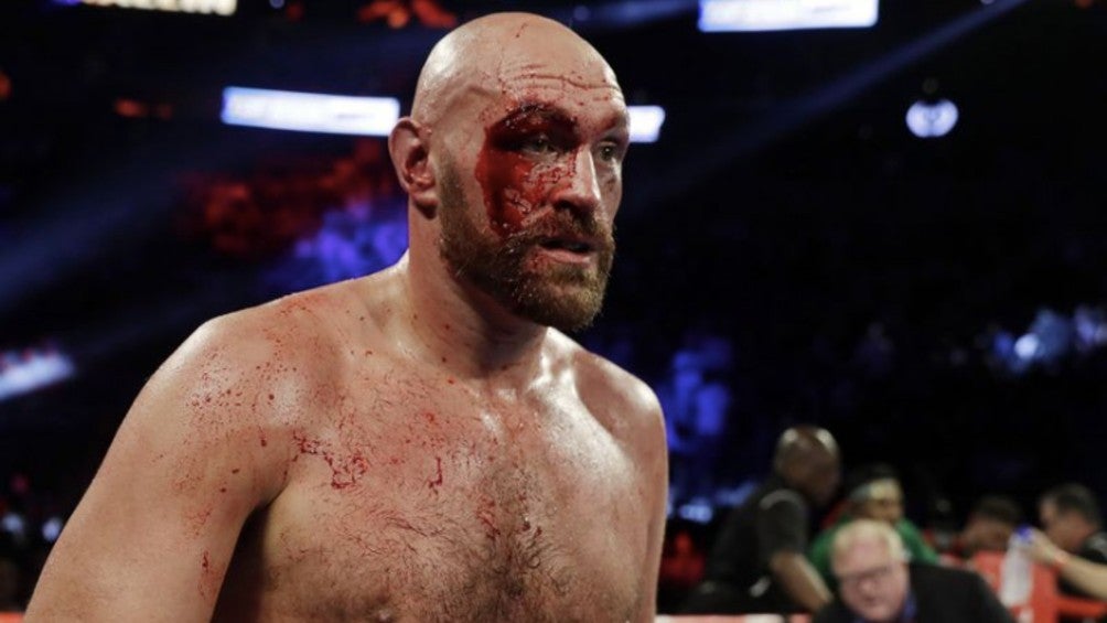 BOX: Tyson Fury no considera que Andy Ruz esté dentro de los cinco mejores del mundo 