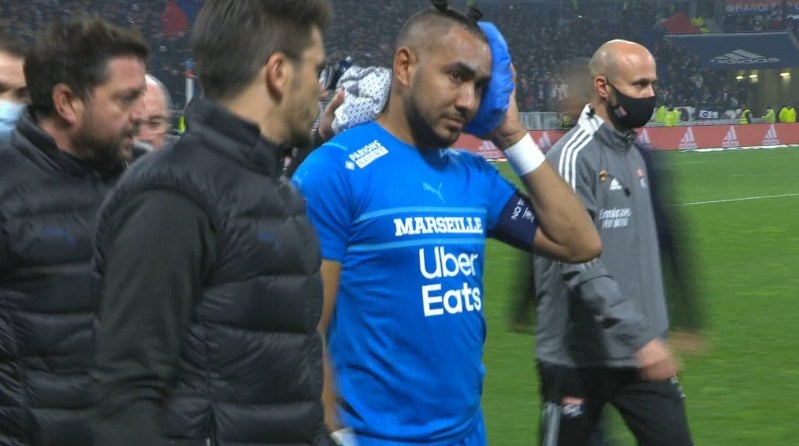 Dimitri Payet tras ser agredido en el Lyon-Marsella