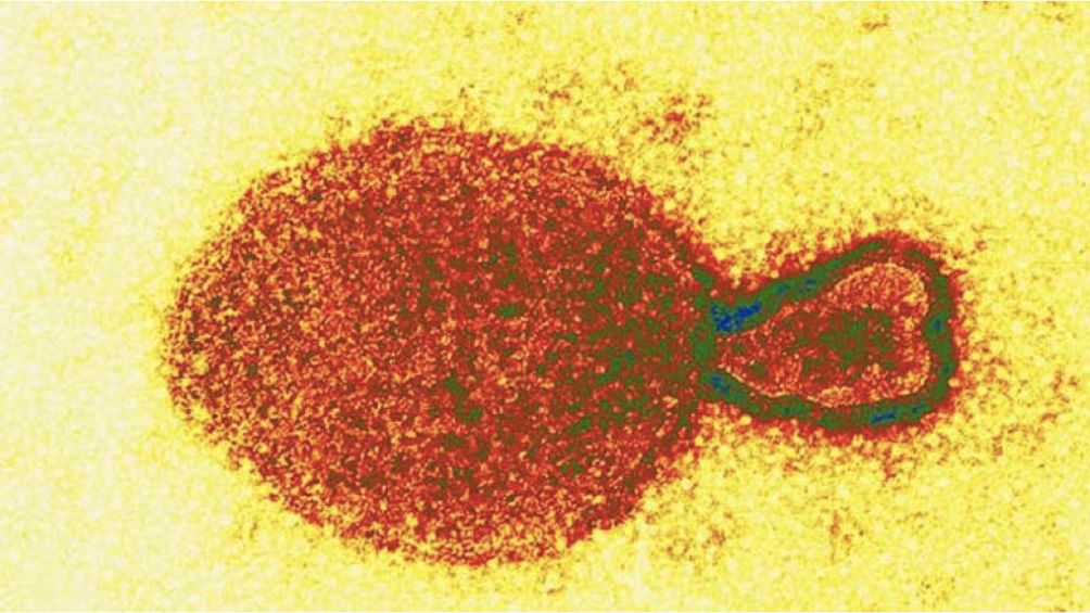 Henipavirus