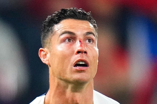 Así terminó el rostro de Cristiano Ronaldo