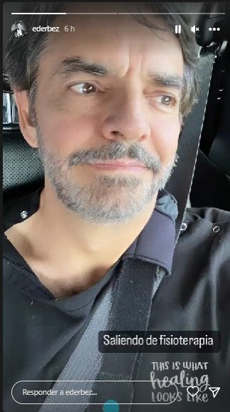 Eugenio Derbez comparte su primera foto tras accidente