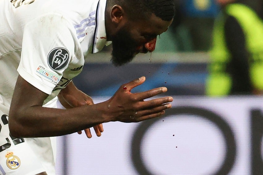 Rüdiger tras recibir fuerte golpe en la cara