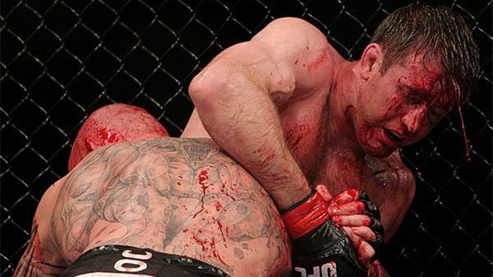 UFC: Muere la leyenda Stephan Bonnar