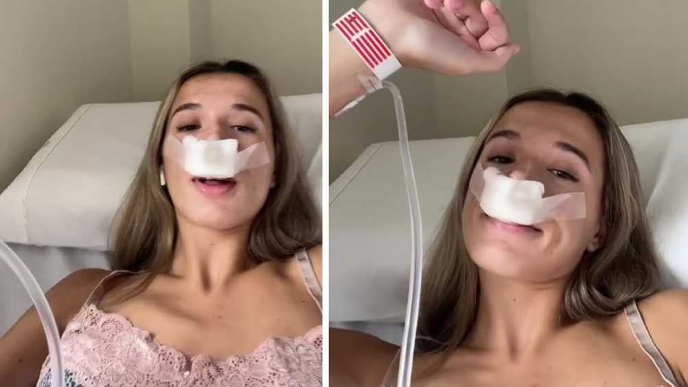 Influencer comparte Tiktok sobre su rinoplastia para que sus hijos “nazcan con linda nariz”