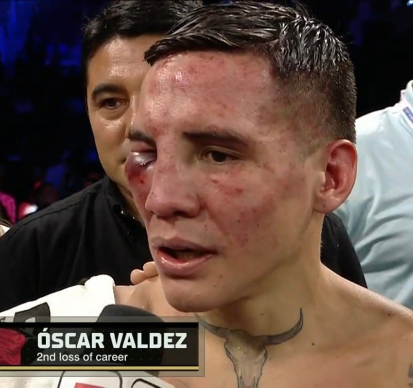 Rostro de Valdez tras la pelea vs Vaquero