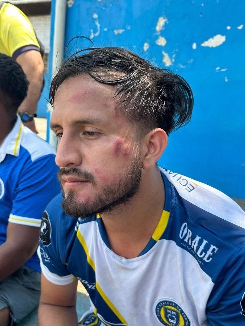 Así quedó el jugador tras el incidente