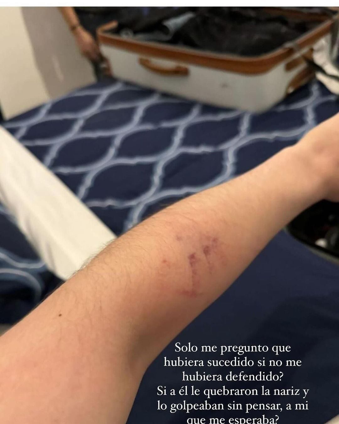 Ivette Camacho resultó sólo con un golpe en el brazo.