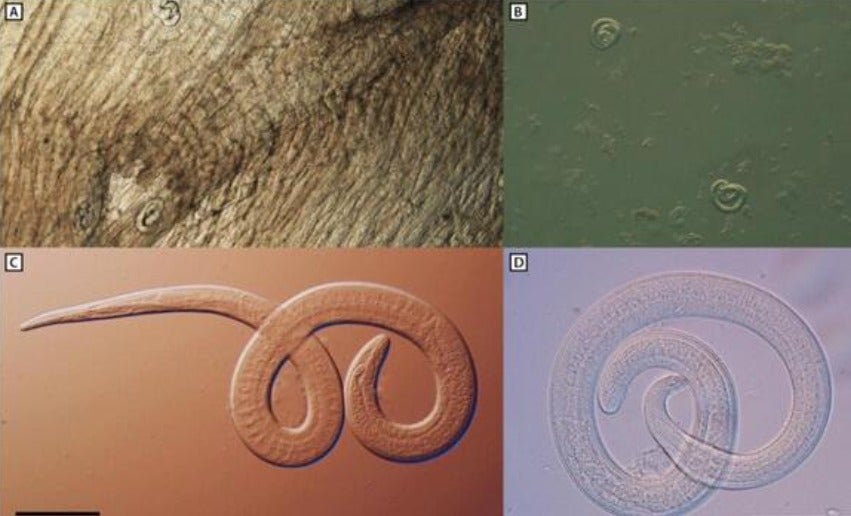 Diferentes exámenes microscópicos de lombrices intestinales Trichinella nativa encontradas en la carne de oso negro que fue la fuente de un brote