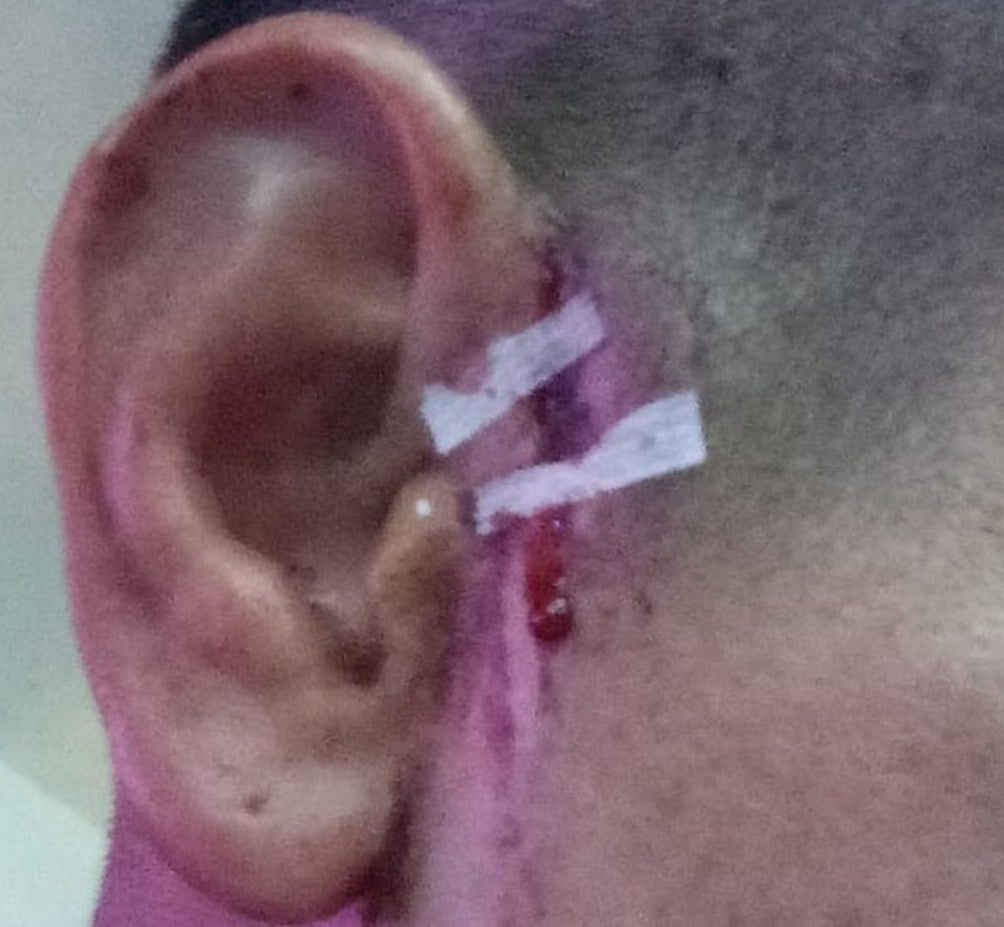 Oreja del jugador agredido