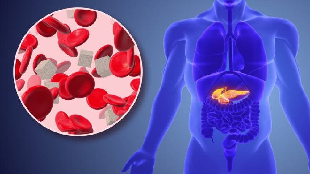 La diabetes es una enfermedad crónica que se caracteriza por niveles elevados de glucosa en la sangre.