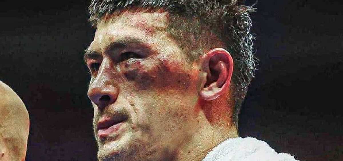 Bivol tras el combate 