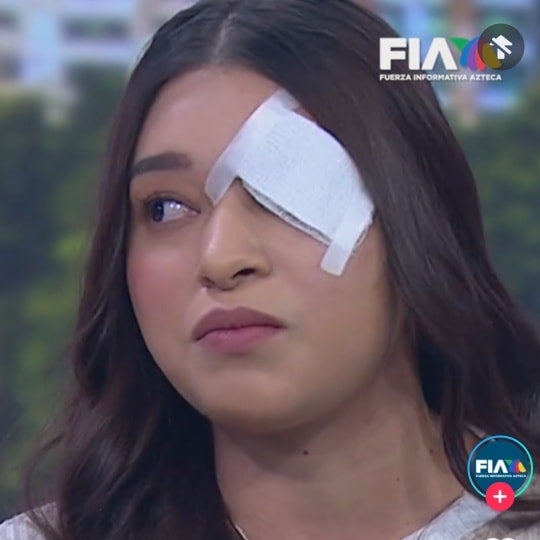 Melanie podría perder el ojo por los golpes que recibió de su novio.