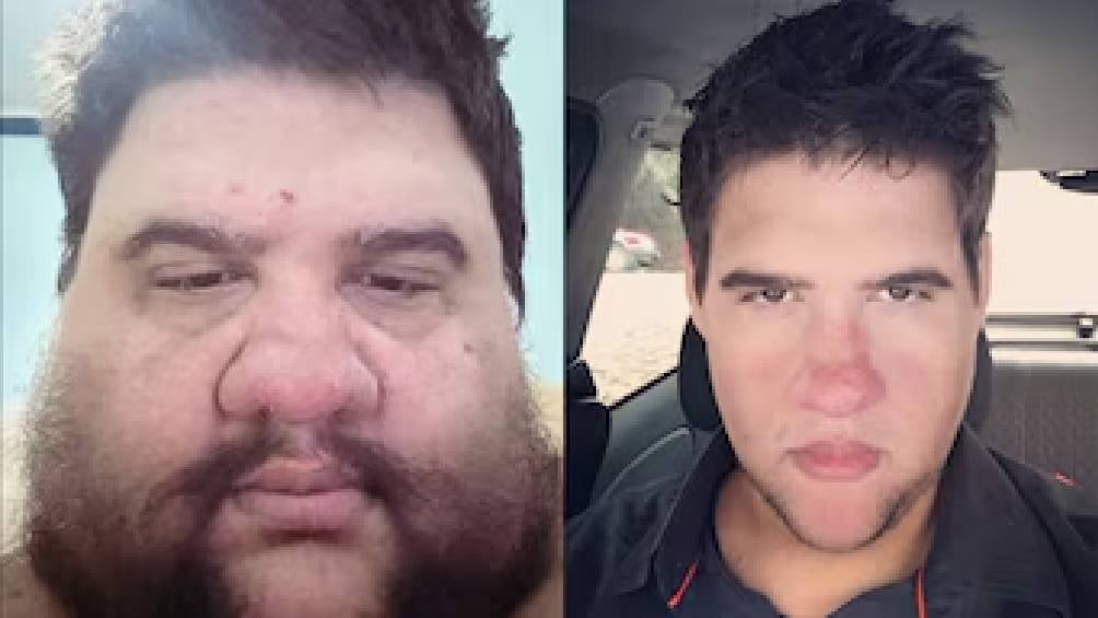 Muere el influencer Gabriel Freitas de un infarto fulminante; había perdido 200 kilos