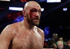 BOX: Tyson Fury no considera que Andy Ruz esté dentro de los cinco mejores del mundo 