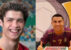 Cristiano Ronaldo antes de las cirugías y después de las mismas