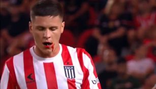 Guido Carrillo tras perder tres dientes por un codazo de su rival