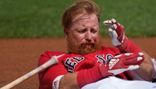 Justin Turner recibió un bolazo en el rostro