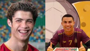 Cristiano Ronaldo antes de las cirugías y después de las mismas