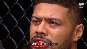 UFC: Justin Tafa casi pierde un ojo tras golpe de Austen Lane y la pelea se detiene