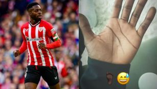 Iñaki Williams jugó por dos años con un cristal enterrado en la planta del pie