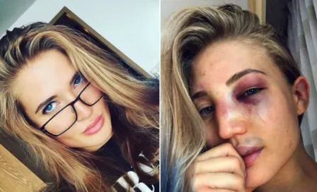 Sexy peleadora de MMA presume en redes su rostro golpeado 