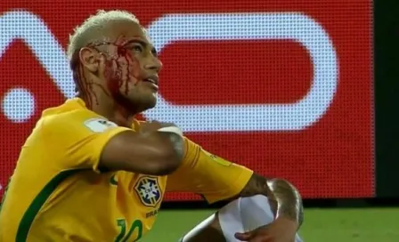 Neymar sufre escandalosa herida en partido frente a Bolivia