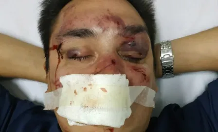 Periodista recibe brutal golpiza por ser seguidor de Racing 