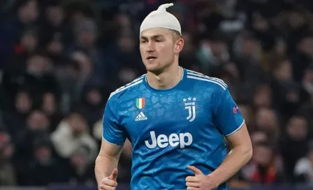 Matthijs de Ligt sufrió impactante corte en la cabeza en el Lyon vs Juventus