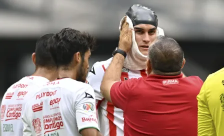 Necaxa: Las fotos de la vistosa herida de Alexis Peña en la cabeza