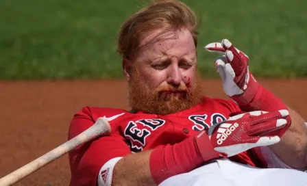 MLB: Justin Turner, de Red Sox, con el rostro golpeado; recibió 16 puntadas